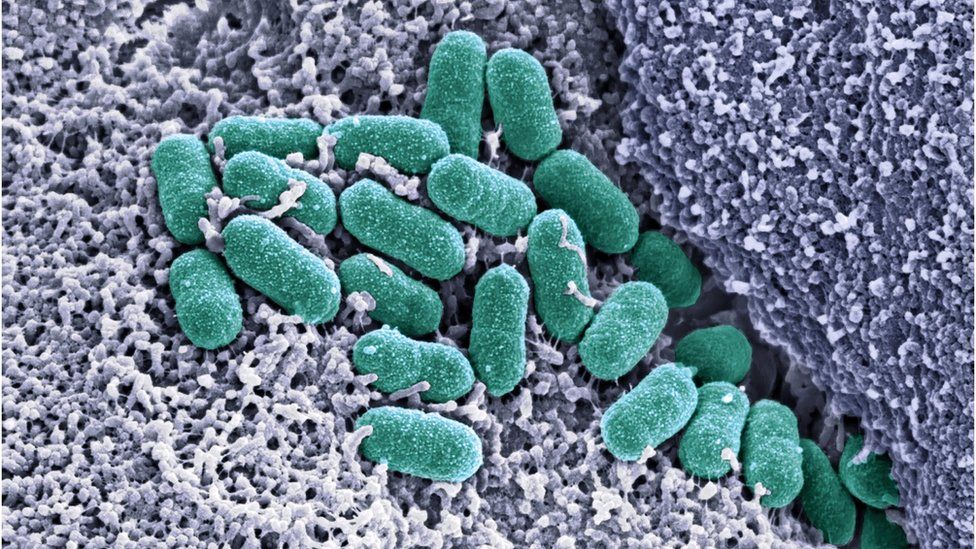 E. coli