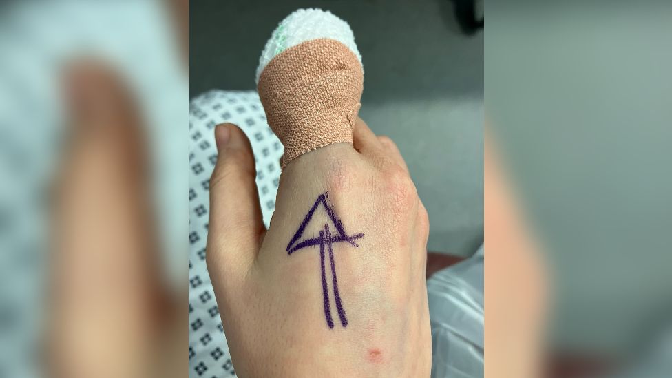 Danica Priest's finger bandaged up