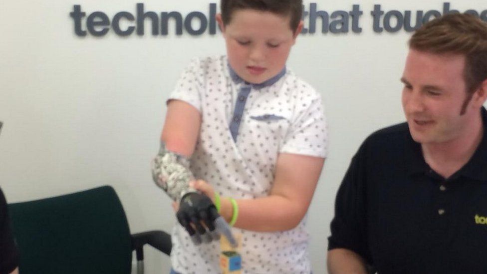 Josh Cathcart becomes youngest ever i-limb wearer