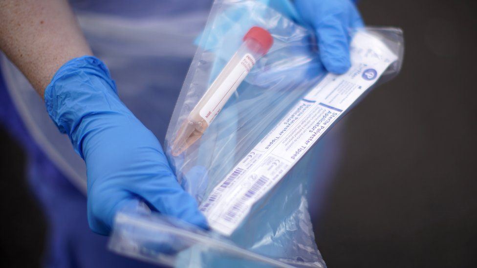 Coronavirus testing kits