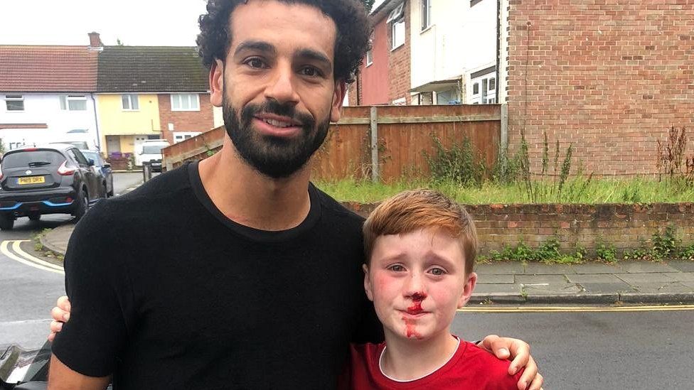 Mohamed Salah and Louis with a bloodied nose