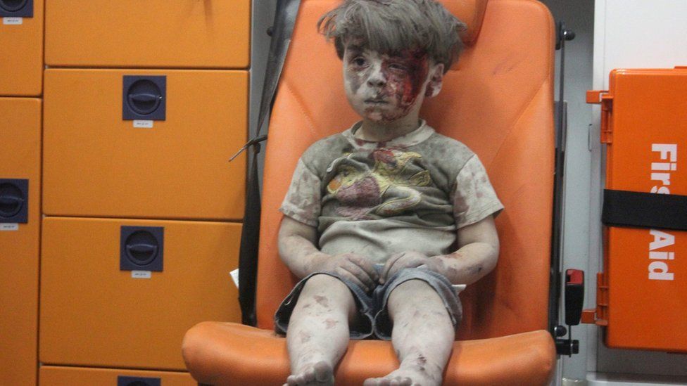 Photo showing Syrian boy Omran Daqneesh after his home was destroyed by an air strike in Qaterji, Aleppo, on 17 August 2016