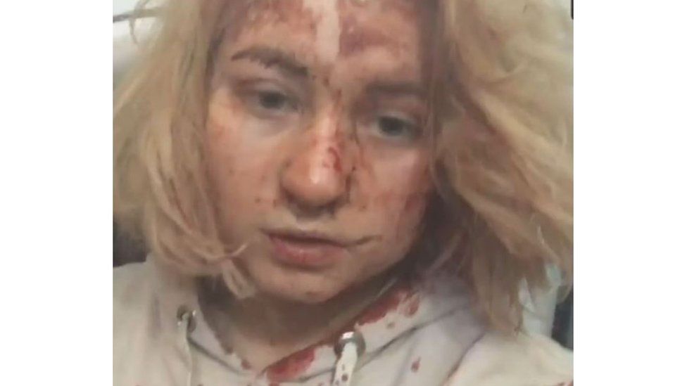 Screenshot of a video showing a young woman covered in blood with visible injuries on her face