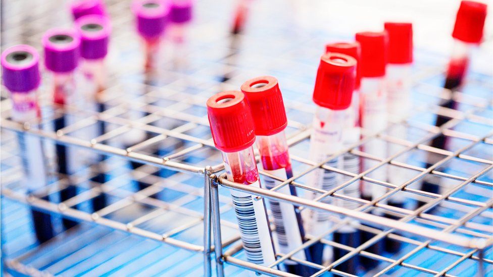 Blood in testing samples