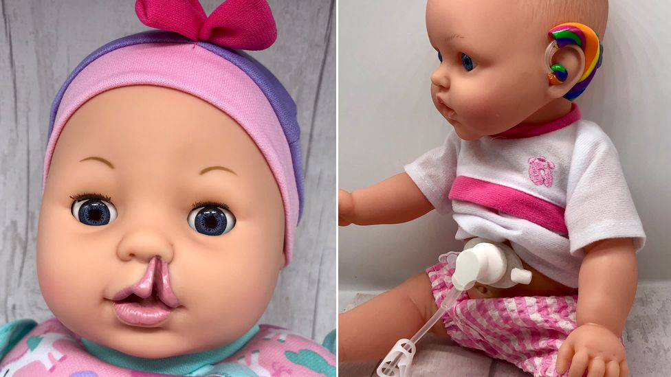 A doll with a cleft palate and hearing aid and feeding tube