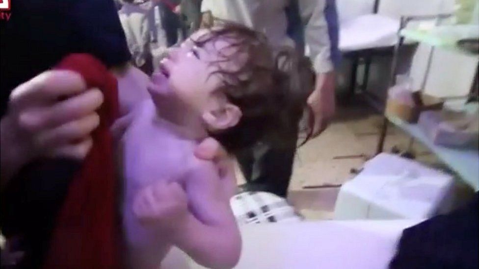 Children affected by suspected chemical weapons attack in Douma
