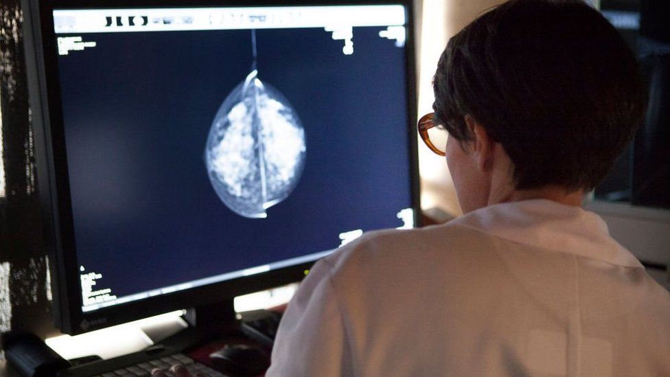 Radiologist looks astatine  mammogram results connected  a computer