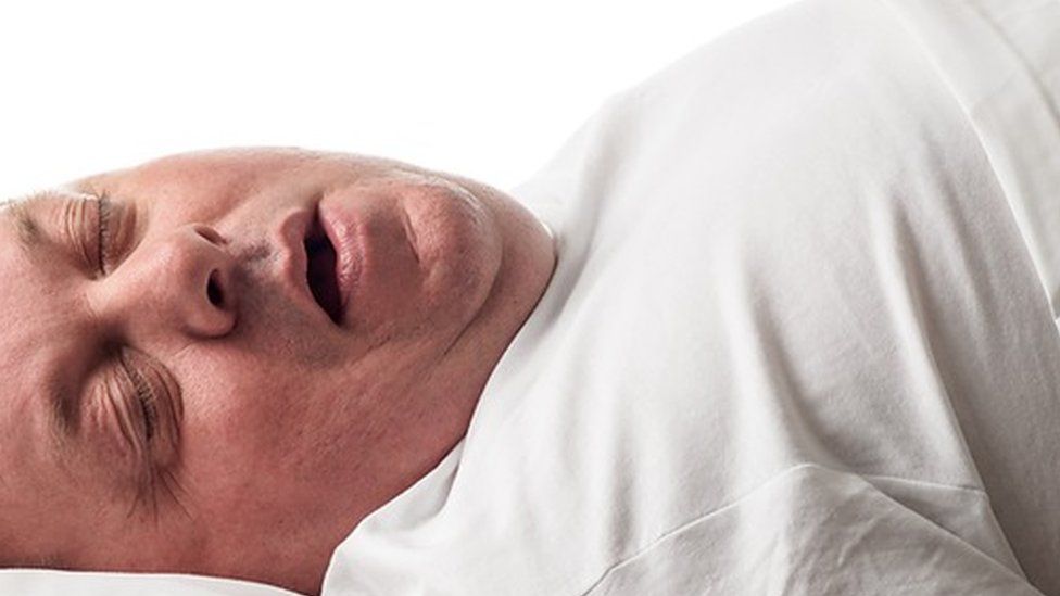 Sleep apnea online fat