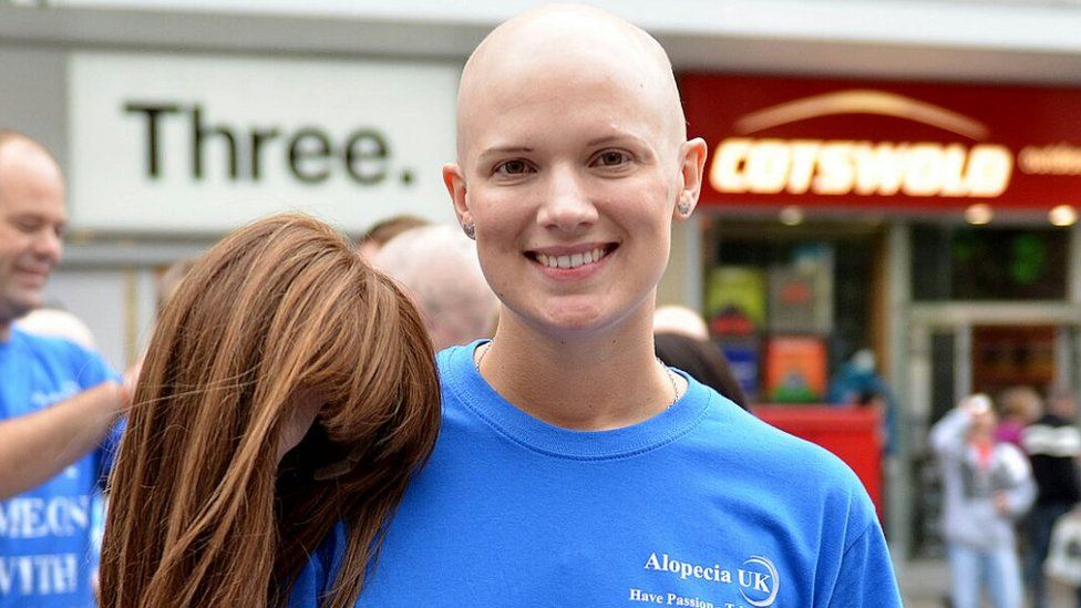 Jen Chambers from Alopecia UK