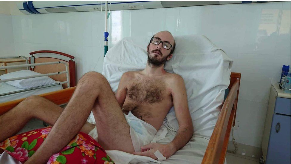 Calvin looking thin in a hospital bed