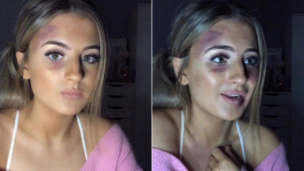 Two images of Amber show the amount of make-up on her face increasing to make it look as though she has been attacked.