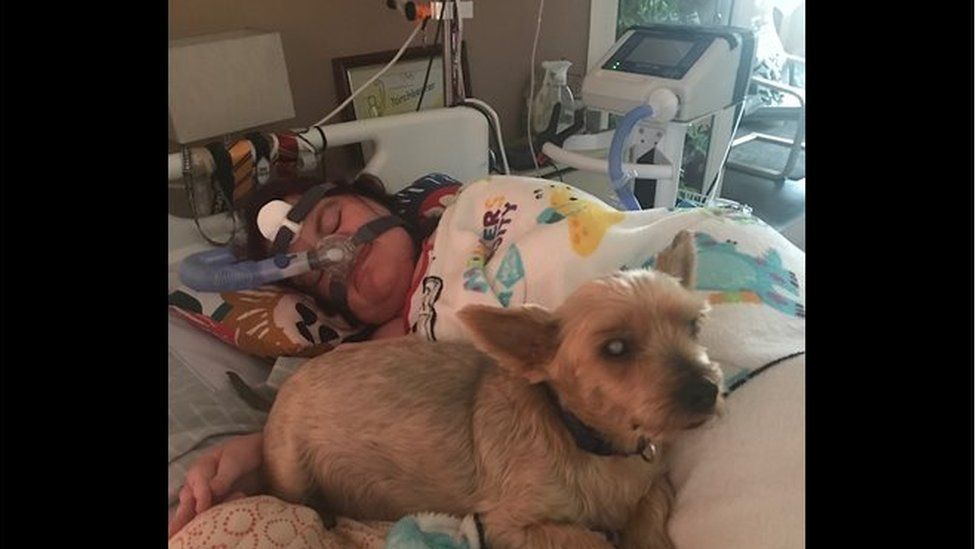 Michaela in bed and using a ventilator while her dog Charlie lies next to her