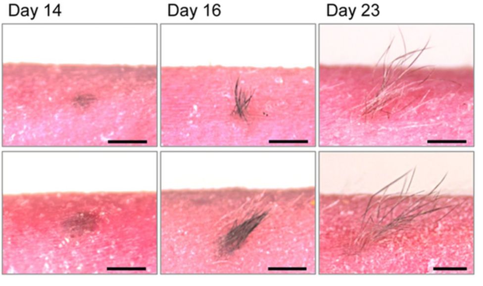 Promising labgrown skin sprouts hair and grows glands BBC News