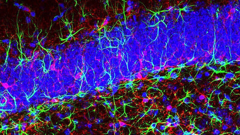 neurons in the hippocampus