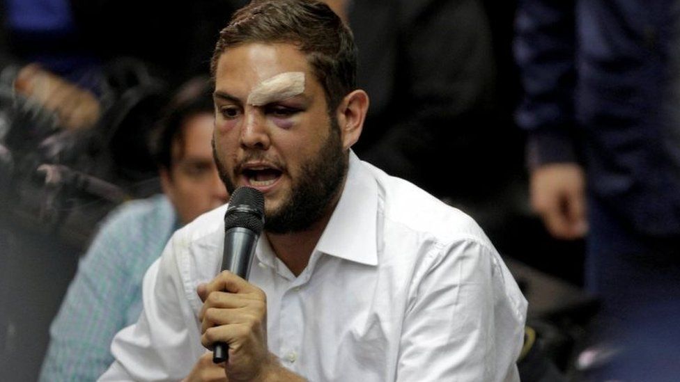Juan Requesens, deputy of the Venezuelan coalition of opposition parties (MUD), speaks during a session of the National Assembly in Caracas, Venezuela April 5, 2017