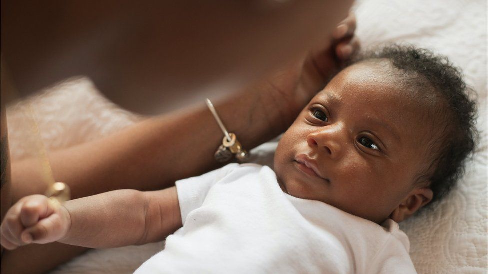 Concerns over focus on skin colour in newborn checks - BBC News
