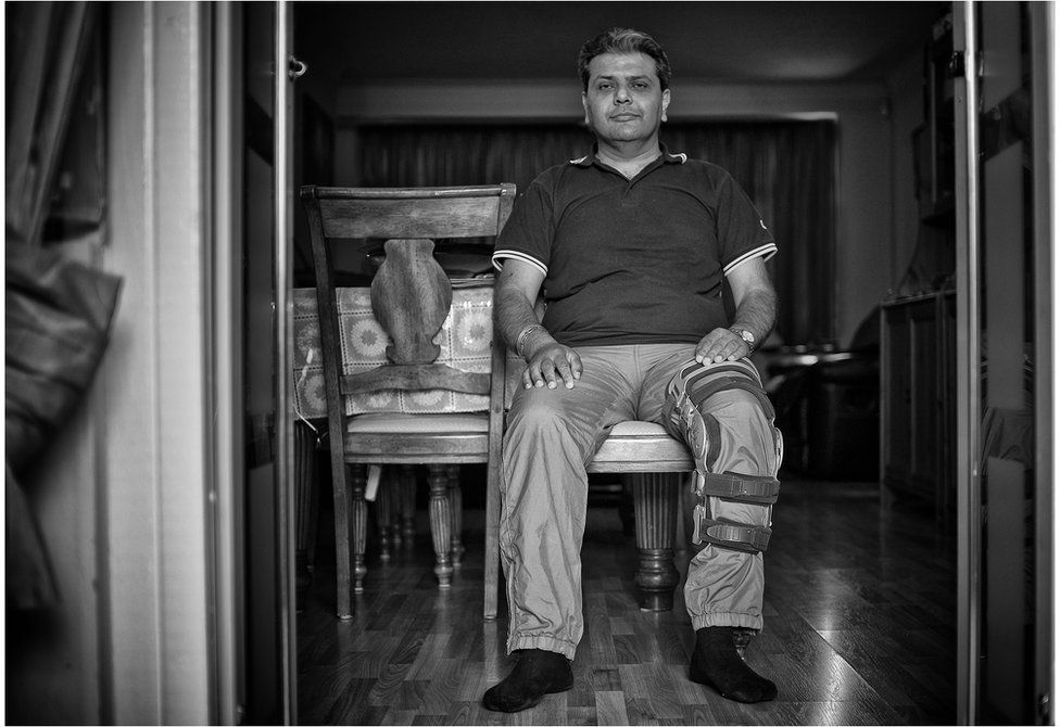 Mukesh Maroo is in the unusual situation of being both a carer for his elderly mother and needing a carer himself after undergoing major knee surgery