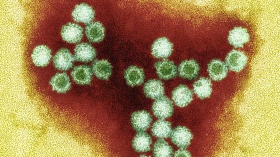 Lincoln County Hospital norovirus outbreak hits nine wards BBC News
