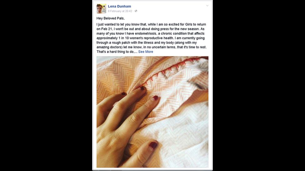 The Girls creator's Facebook post says she's going through a "rough patch" with the illness