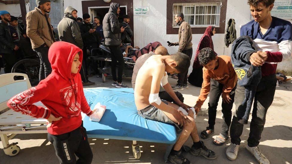 Palestinians receive medical care at Kamal Adwan Hospital in Beit Lahia, in the northern Gaza Strip, on 29 February 2024