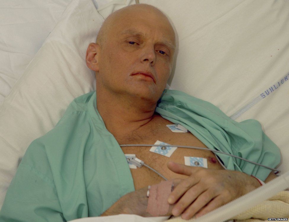 Alexander Litvinenko is pictured at the Intensive Care Unit