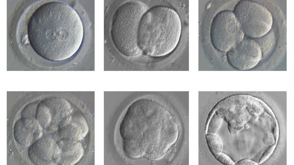 Human embryo development
