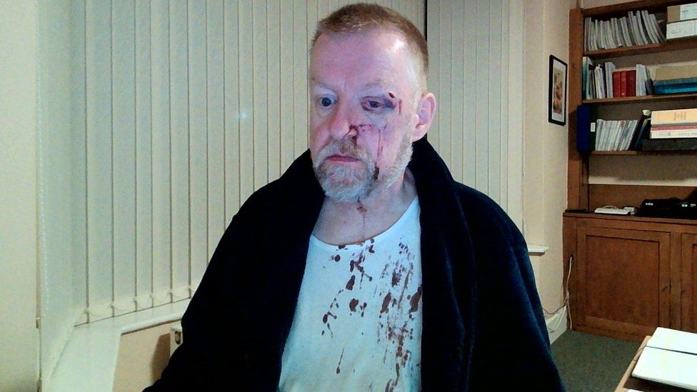 Father Colin Mason with an injured and bloodied face