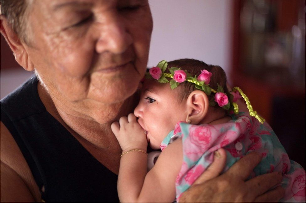 Ana Beatriz, a baby girl with microcephaly, celebrates her first fourth months of life in Lagoa do Carro, Pernambuco, Brazil, on 8 February 2016.
