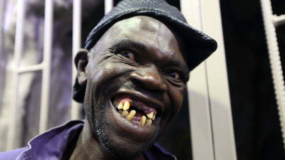 Ugly Man With No Teeth
