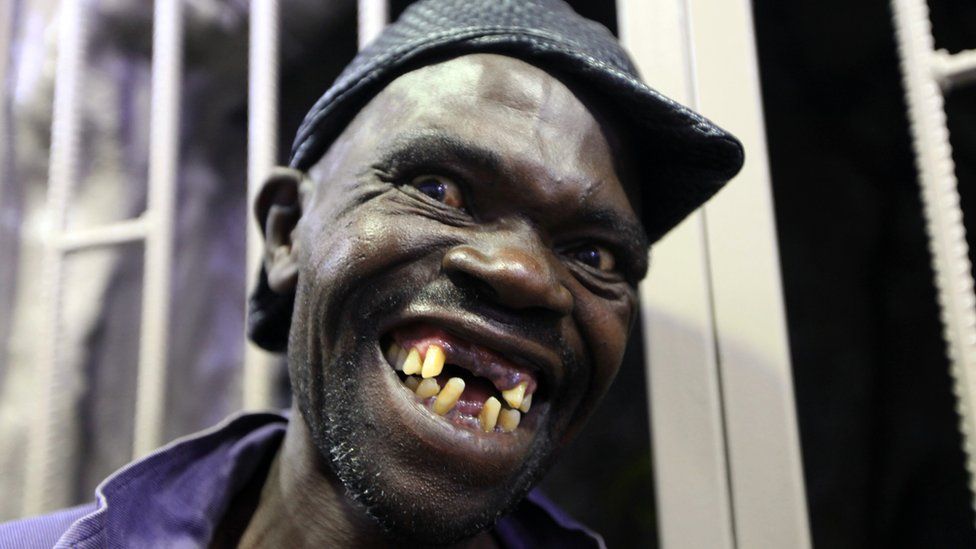 world's ugliest teeth