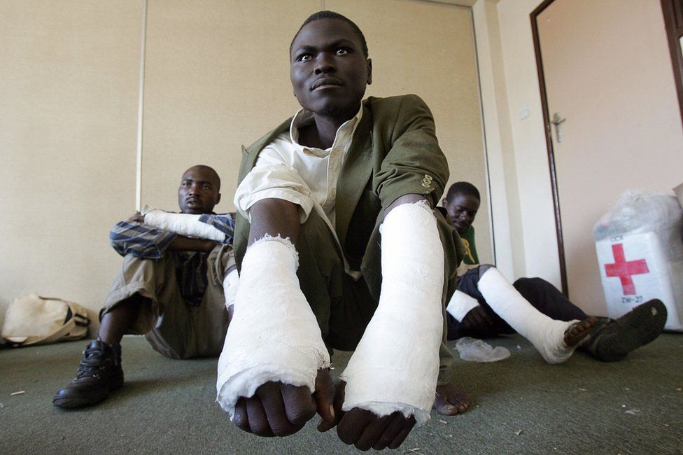 Three members of the Movement for Democratic Change (MDC) who say they have been beaten by members of Mugabe's youth with sticks in the Masvingo 300km south of Harare pose on May 3, 2008 in Harare.