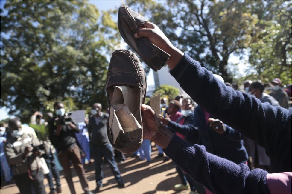 A nurse shows her torn shoes as she and other health workers stage a protest at the Parirenyatwa Hospital in Harare, Zimbabwe.