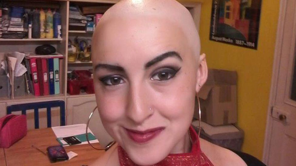 Josie without hair