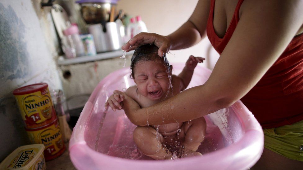 A child born with microcephaly is bathed by her mother in Brazil