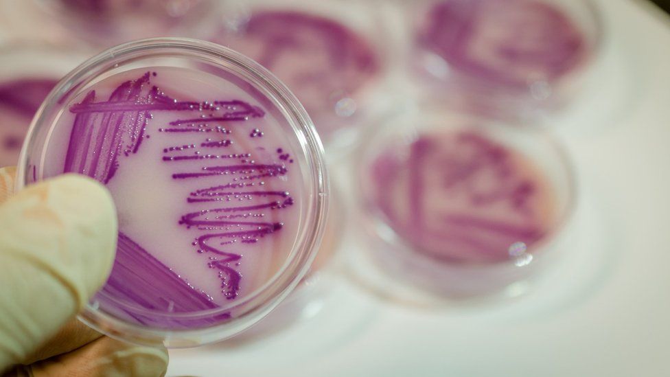Bacterial culture plate with E. coli colony