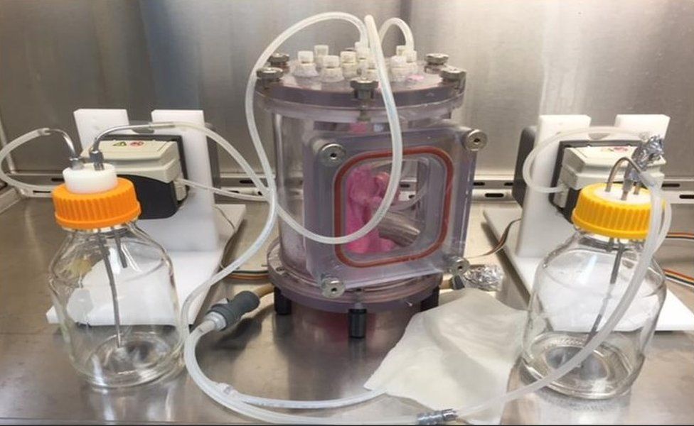 Bioengineering of lung in bioreactor
