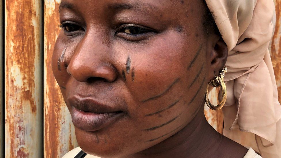 Woman with facial scars
