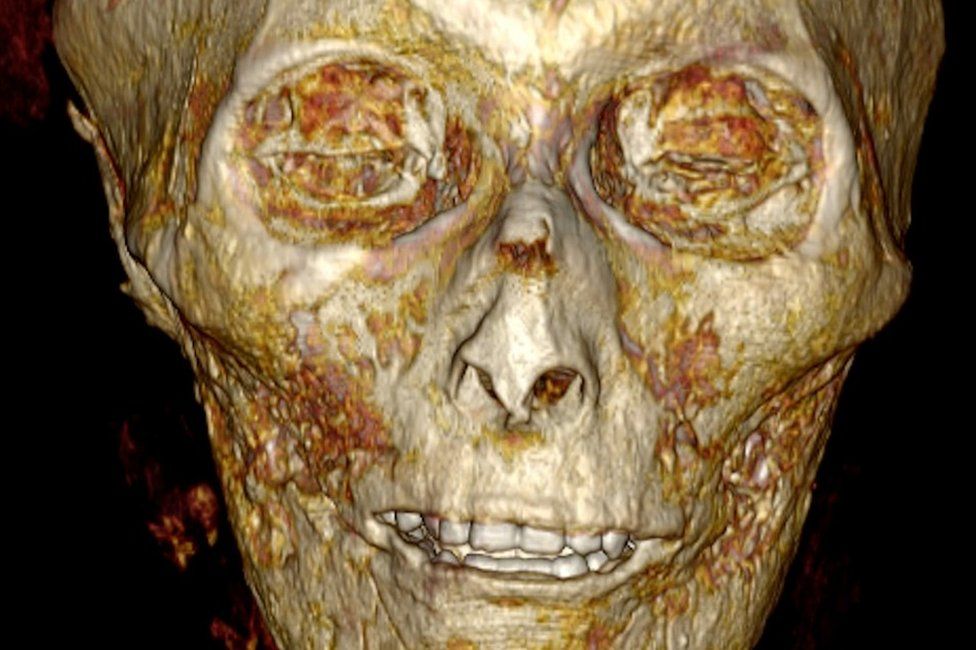 CT scan showing the skυll of Aмenhotep I