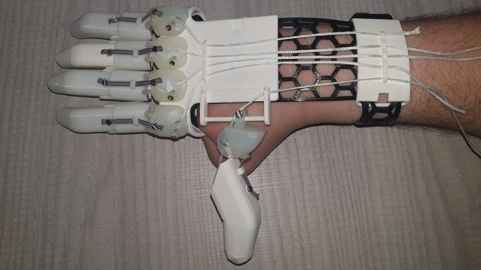 A prosthetic hand