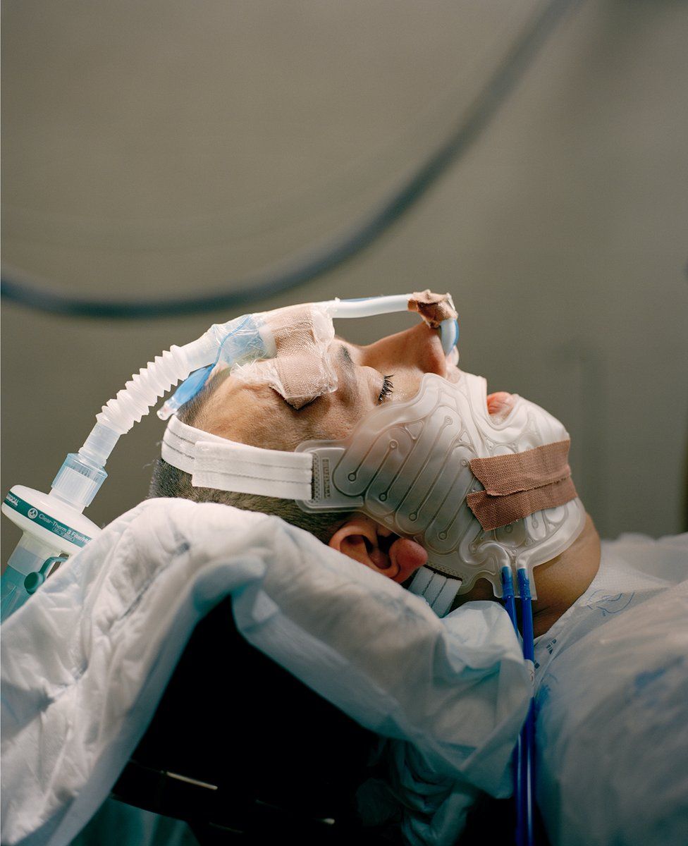 A portrait of a patient being treated in hospital