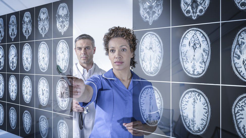 Krankenschwester und Arzt beim Betrachten von Gehirnscans