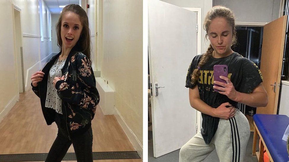 On the left is a photograph of Hannah Gane when she was suffering with anorexia. On the right is a photo of Hannah at a healthy weight