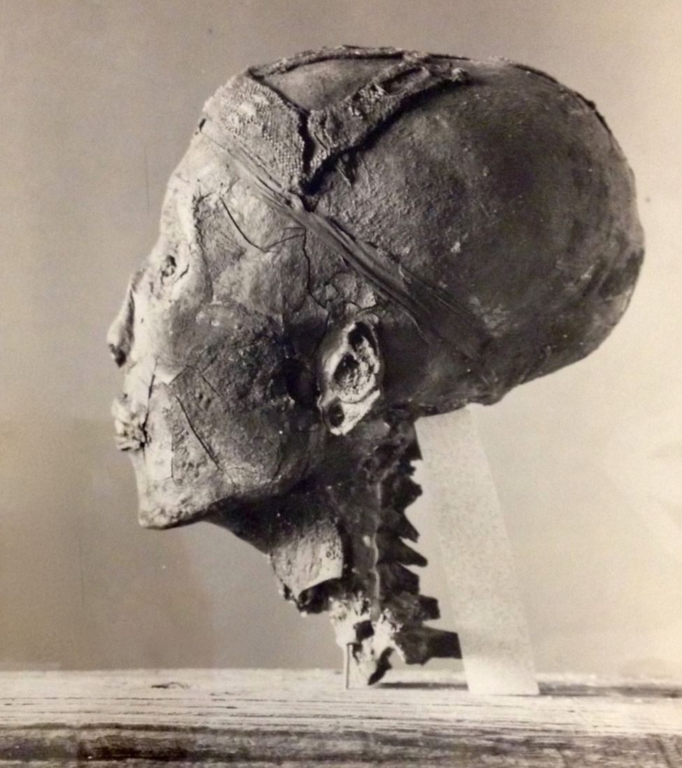 Profile photograph of King Tutankhamun's head