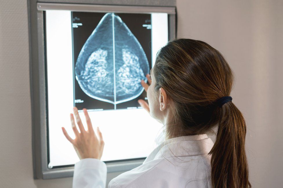 portaaviones etapas del cáncer de próstata