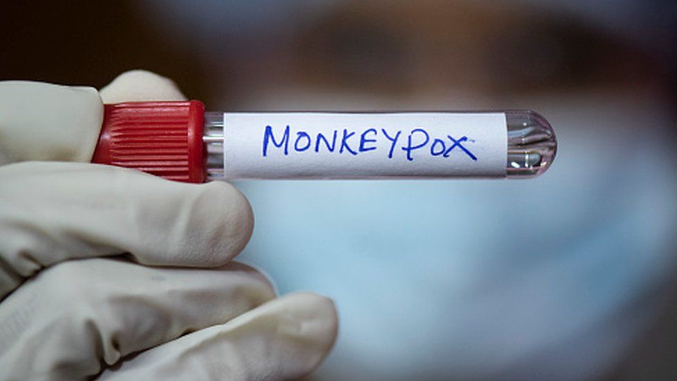 A medical professional holds a test tube labelled monkeypox