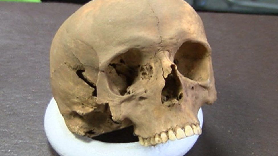 Skull of Richard de W'Peton, who died 17 April 1317
