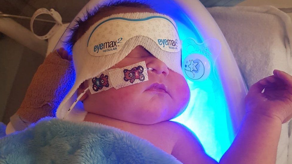 Baby Kia in the neonatal unit
