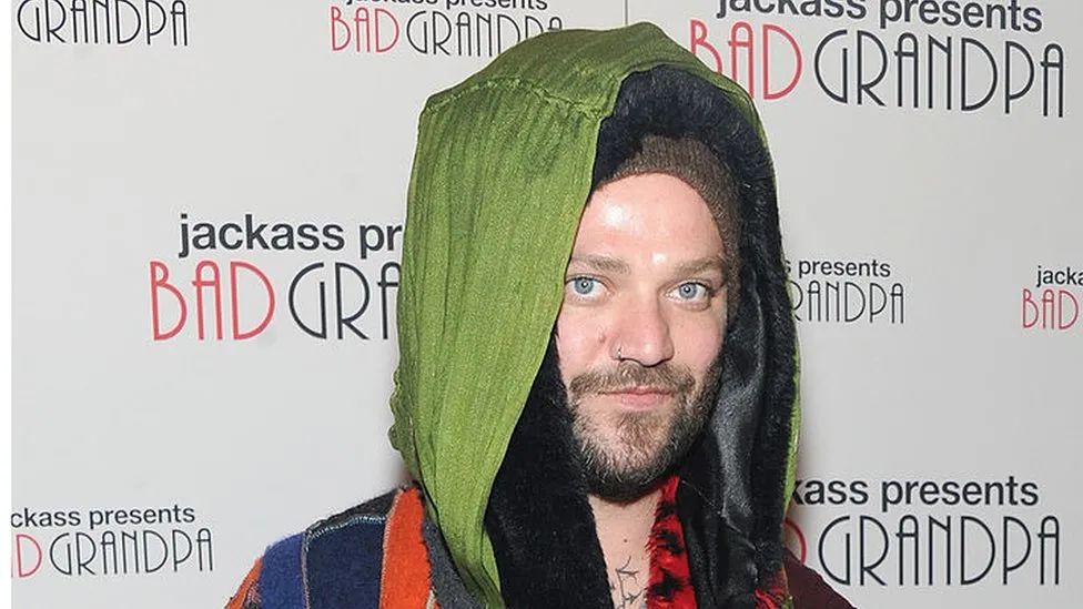 Jackass star Bam Margera turns himself in to police over alleged assault