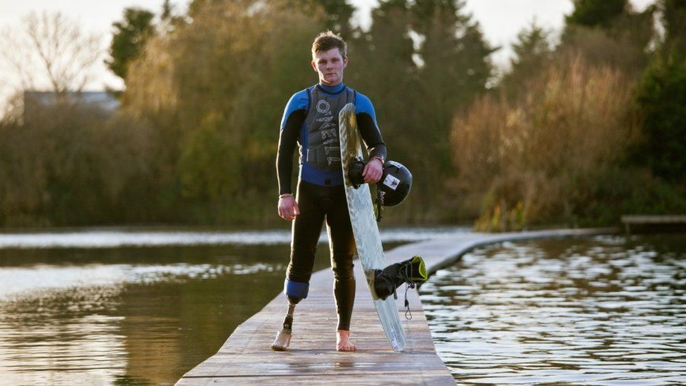 Owen Pick stands with his wakeboard and shows his prosthetic leg