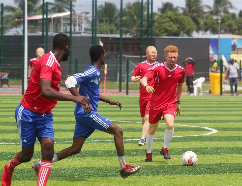 People play a football match organised by the Liberia Albino Society(LAS) on 11 June 2022 ahead of International Albinism Awareness Day on 13 June.